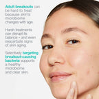 Breakout Biotic Moist 50ml