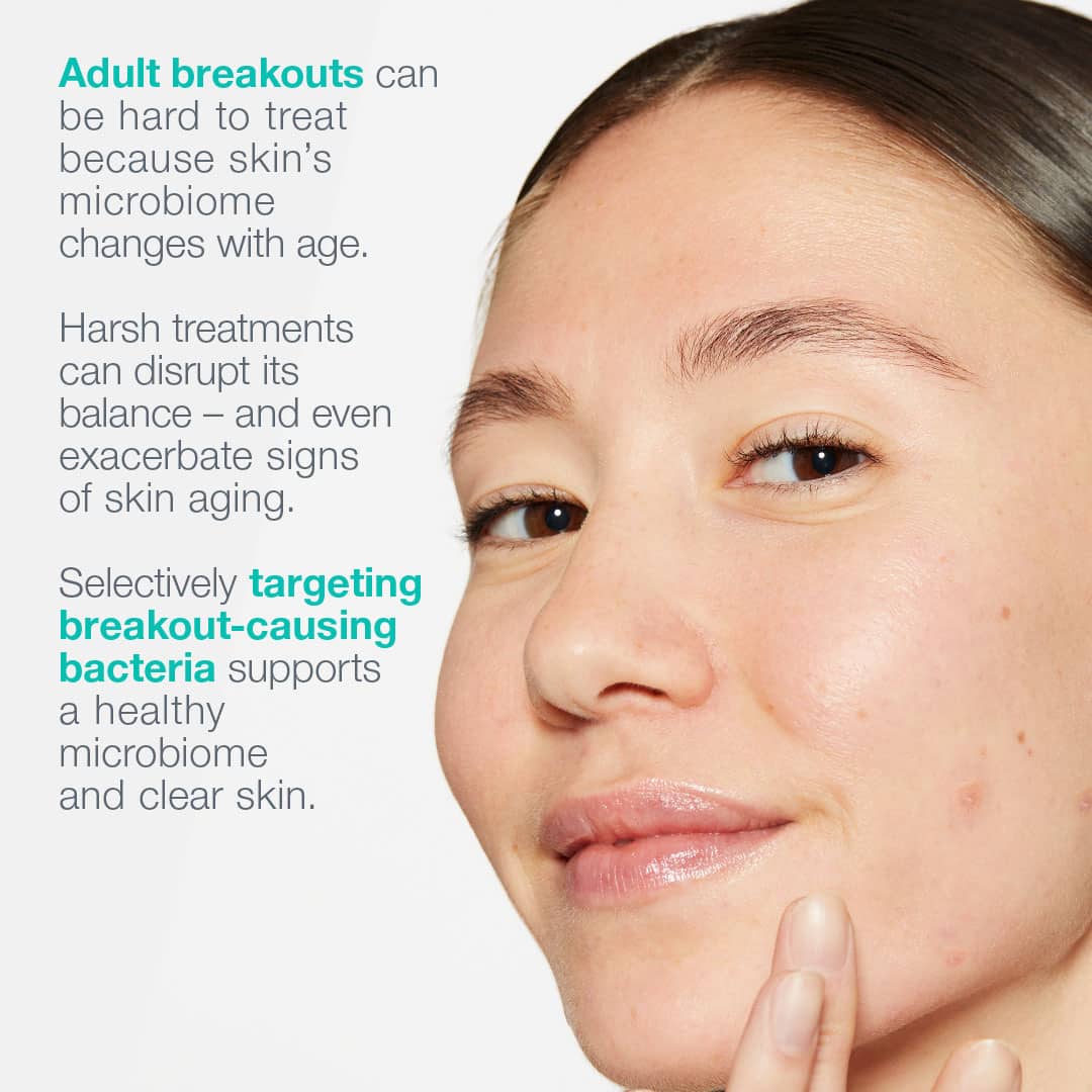 Breakout Biotic Moist 50ml
