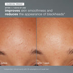 Daily Microfoliant before and after results