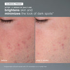 Daily Microfoliant before and after results