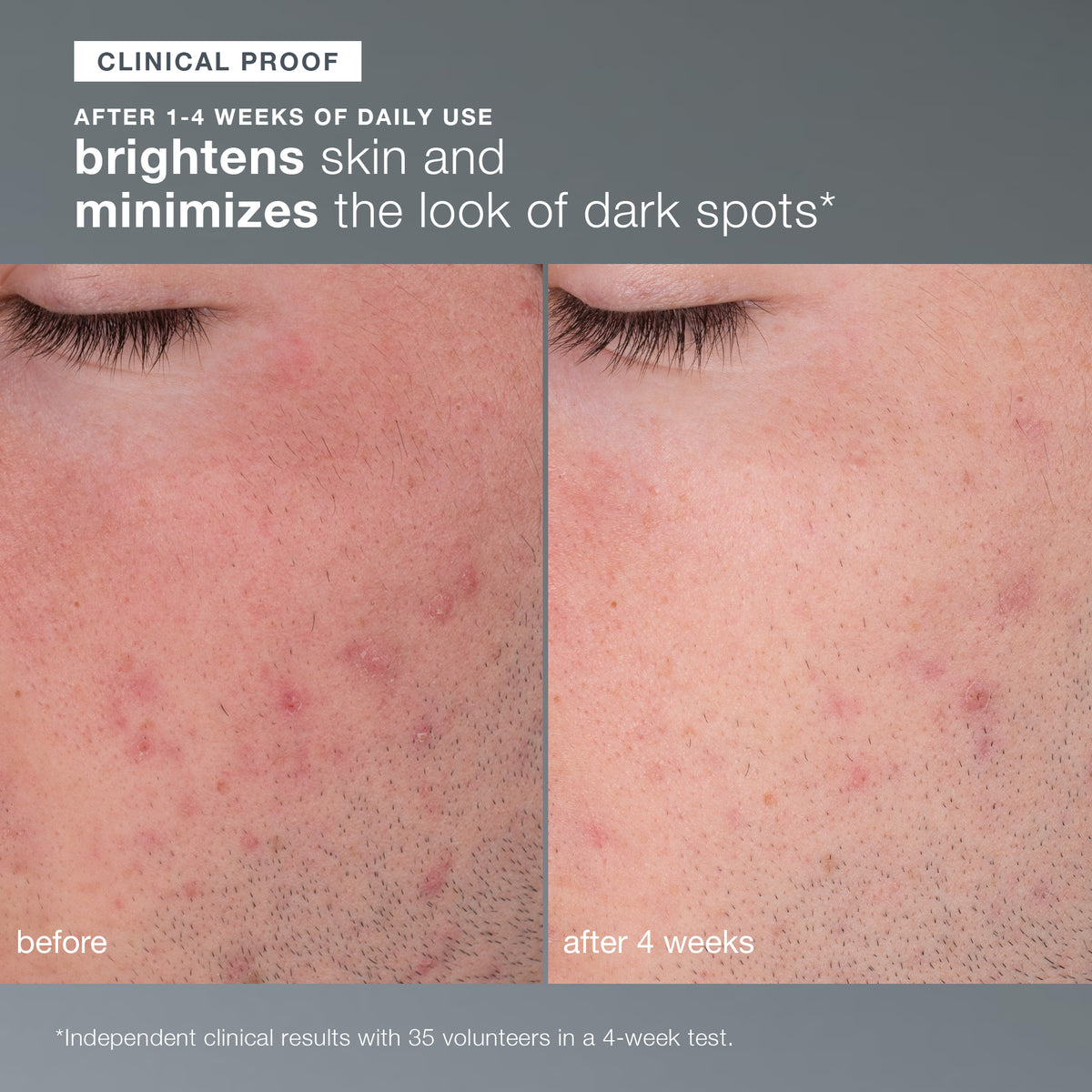 Daily Microfoliant before and after results