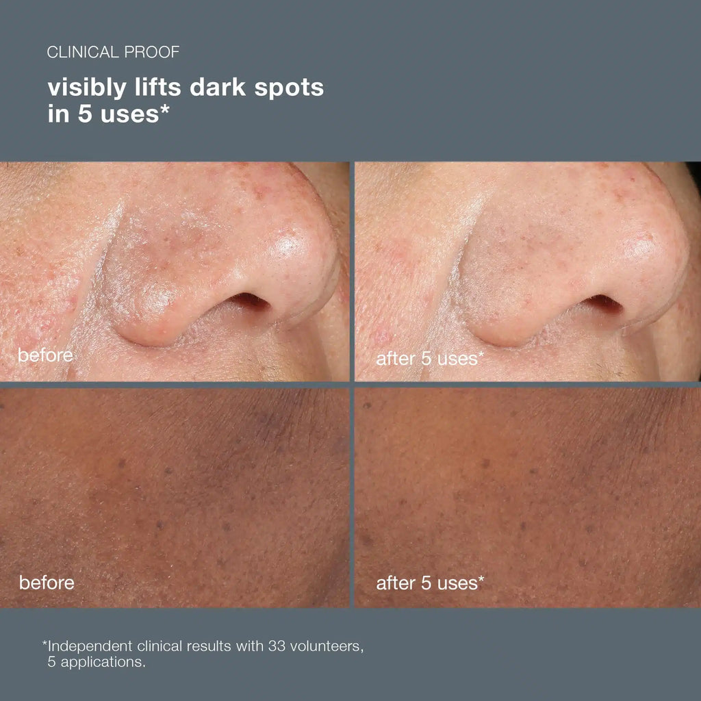 Powerbright Dark Spot Peel 50ml