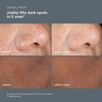 Powerbright Dark Spot Peel 50ml