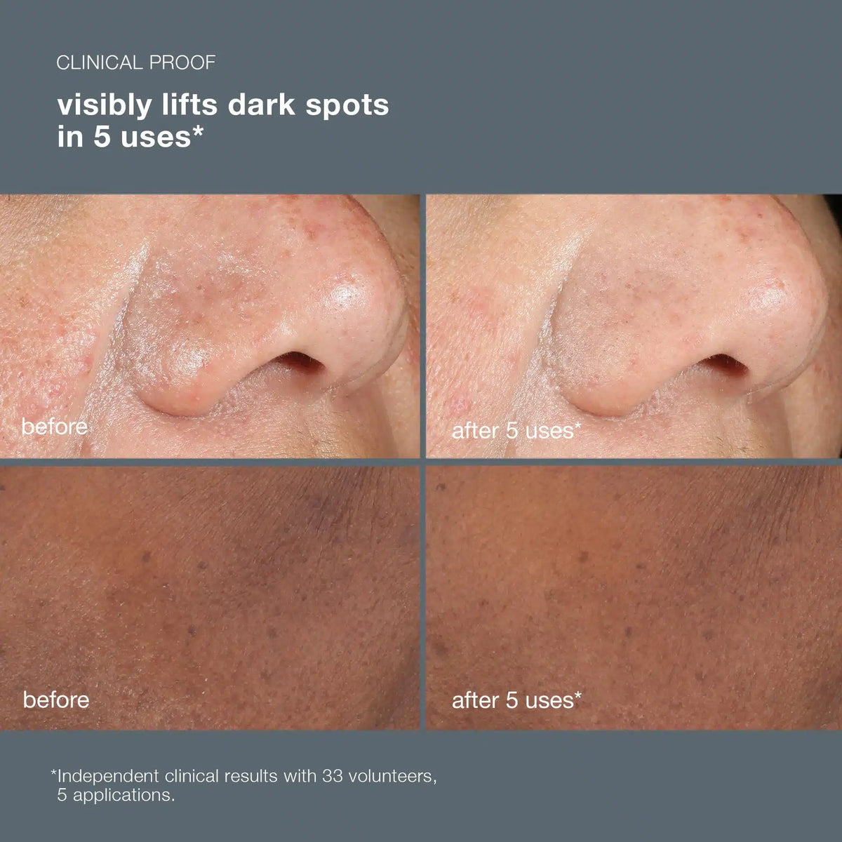 Powerbright Dark Spot Peel 50ml