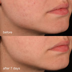 Procollagen Banking Serum 30ml