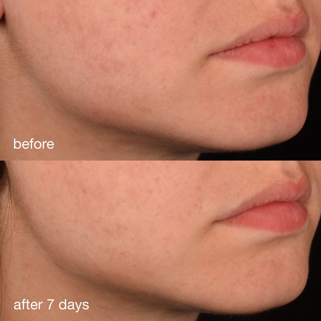 Procollagen Banking Serum 30ml
