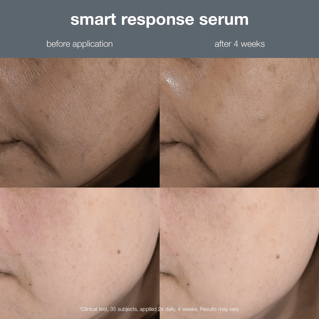 Jumbo Smart Response Serum 59ml