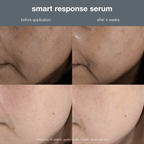 Jumbo Smart Response Serum 59ml