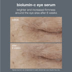Biolumin-c Eye Serum 15ml