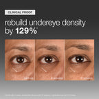 Smart Eye Density Serum 15ml