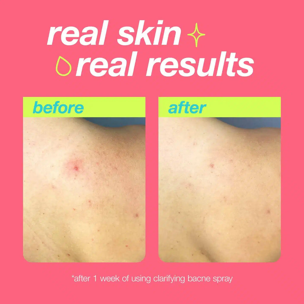 Clarifying Body Spray 177ml
