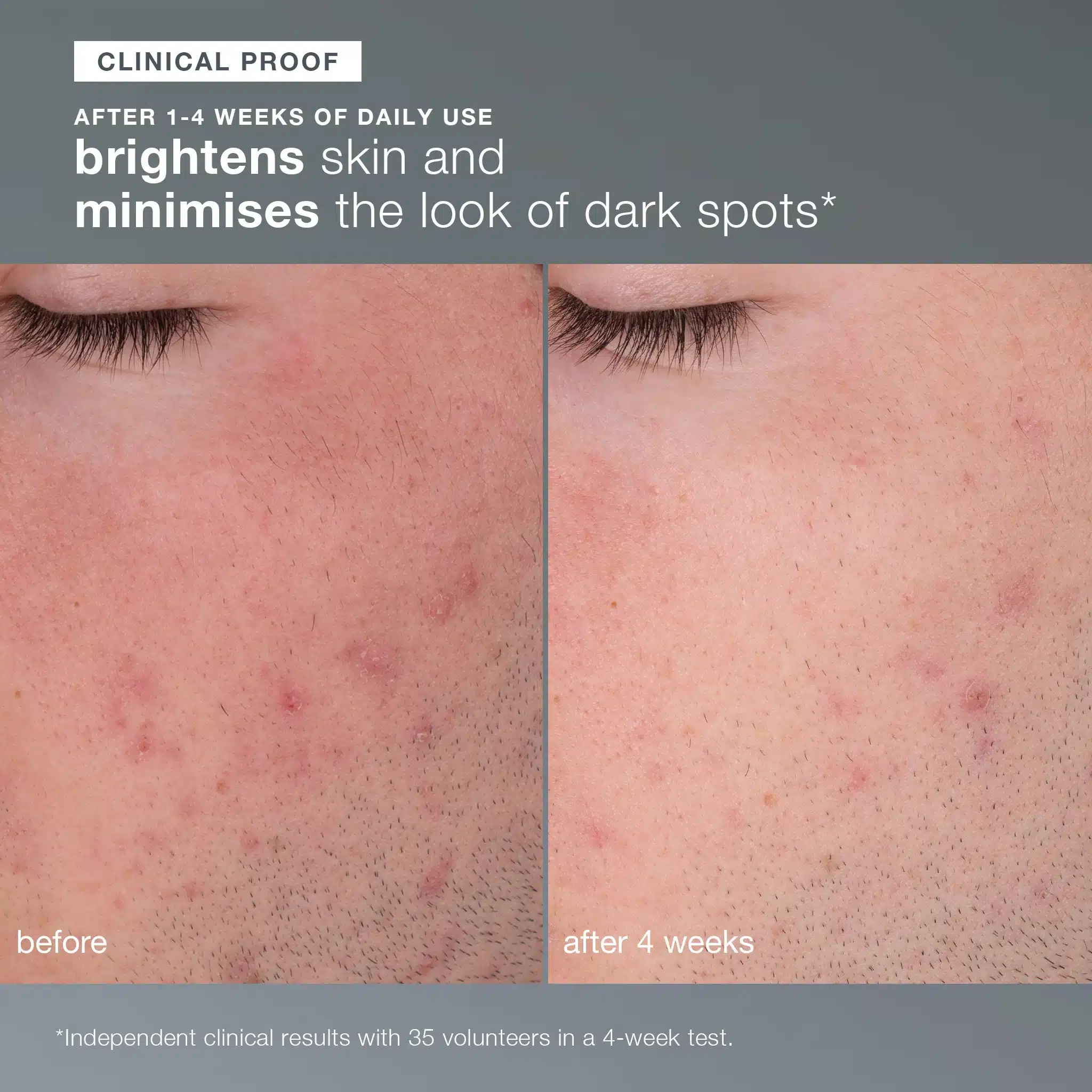 Daily Microfoliant |
